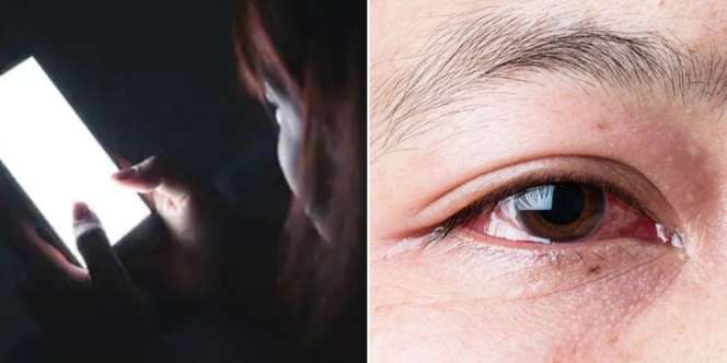 Kecanduan Game Sebelum Tidur, Wanita Ini Alami Risiko Kebutaan
