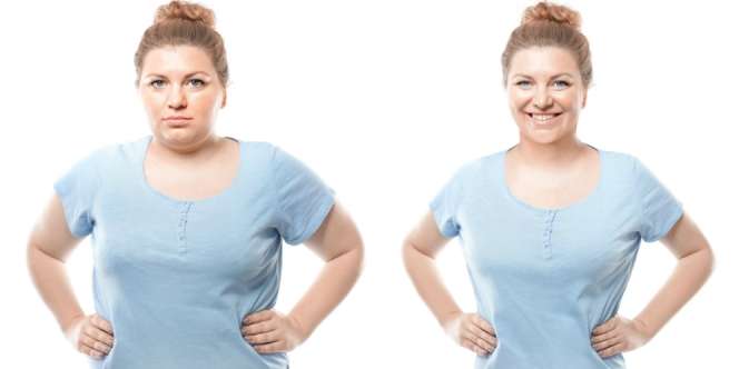 Tips Cegah Timbulnya Stretch Marks Saat Turunkan Berat Badan