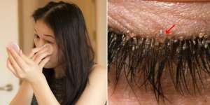 Males Bersihkan Make Up, Bulu Mata Wanita Ini Jadi Sarang Tungau