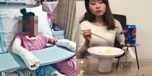 Tiru Cara Masak Popcorn di Yotube, 1 Tewas, 1 Luka Parah