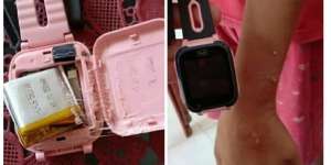 Viral Jam Tangan 'KW' Meledak Saat Digunakan, Waspada!
