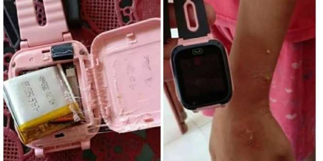 Viral Jam Tangan 'KW' Meledak Saat Digunakan, Waspada!