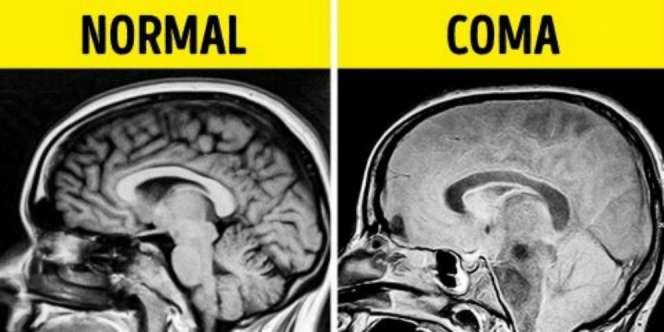 10 Hasil Rontgen Tubuh Manusia Ini Pasti Bikin Kamu Terkejut