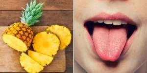 Penyebab Lidah Terasa Sakit dan Gatal Usai Makan Nanas