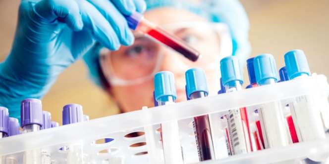 Viral, Cerita Istri yang Bersuamikan Pengidap HIV Positif