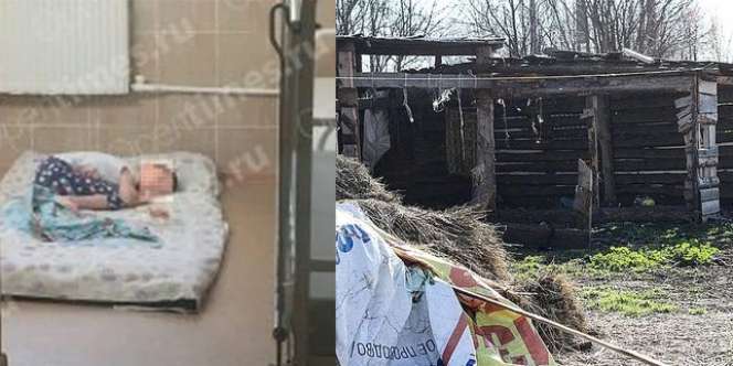 Kisah Bocah 12 Tahun Hanya Bisa Menyalak dan Merangkak seperti Binatang