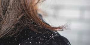 Cara Menghilangkan Ketombe Membandel dan Rambut Rontok