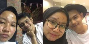 Viral! Pesan Menyentuh Pemuda tentang Pacarnya yang Jerawatan Parah