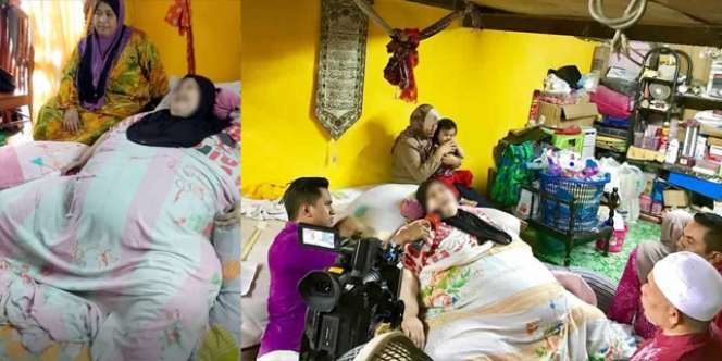 Derita Penyakit Aneh, Bobot Jadi 200 Kg dalam 3 Bulan Sampai Akhirnya...