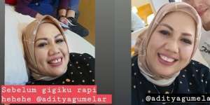 Ingin Potong Gigi Seperti Elly Sugigi? Cek Faktanya!