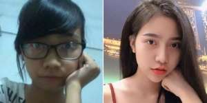 Jalani Operasi Plastik Diam-Diam, Wanita Ini Tak Dikenali Saat Pulang ke Rumah