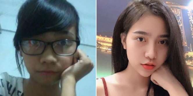 Jalani Operasi Plastik Diam-Diam, Wanita Ini Tak Dikenali Saat Pulang ke Rumah