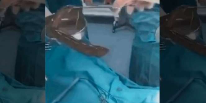 Telan Belut Hidup Buat Obati Sembelit, Usus Si Pria Bolong 2 Cm