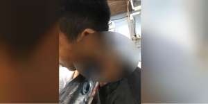 Ngeri! Leher Siswa SMP Tertancap Moncong Ikan