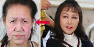 Kisah Pilu Gadis Usia 15 Tahun Di-bully karena Wajahnya Mirip Nenek-Nenek