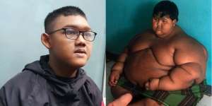 Cerita Arya Permana Berjuang Turunkan Berat Badan 110 Kg
