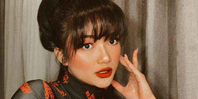 Pose Kenakan Rok Belahan Tinggi, Bekas Luka Kaki Marion Jola Bikin Salfok