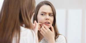 5 Tips Membuat Wajah Bebas Jerawat