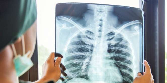 Penularan Virus Corona Lebih Cepat Dibanding Flu Burung