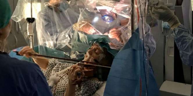 Pasien Mainkan Biola Selama Operasi Tumor Otak