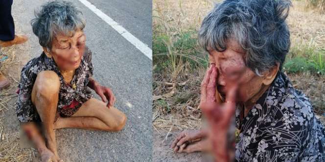 Miris, Cucu Mabuk Hajar Nenek Sampai Tidur di Jalanan