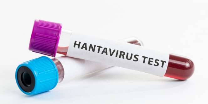 Hantavirus Bikin Geger di China, Lebih Mematikan dari Covid-19  