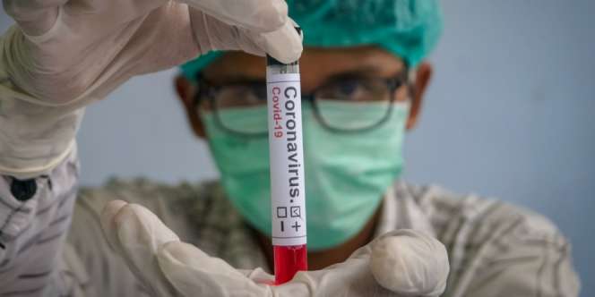 Balita di Purbalingga Positif Corona usai Pulang Kondangan dari Jakarta