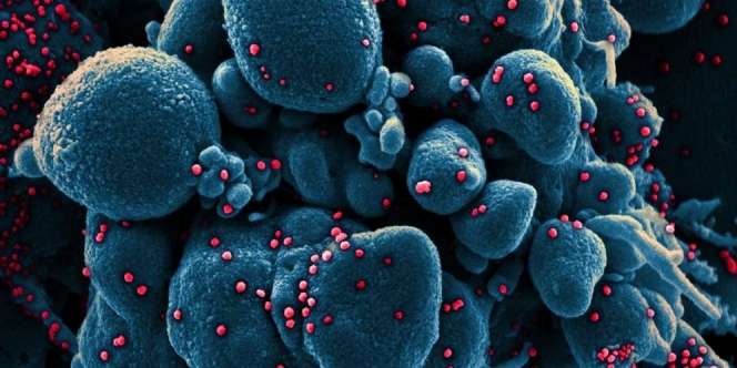 Waduh... Gubernur Ini Bilang Orang Miskin Kebal Corona