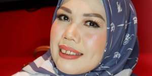 Sudah Bisa Mingkem, Bikin Pangling Penampilan Elly Sugigi Setelah Pakai Behel