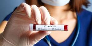 Puskesmas Ikut Sediakan Layanan Periksa COVID-19