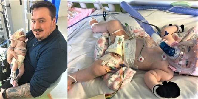 Perjuangan Bayi 6 Bulan Melawan Covid-19