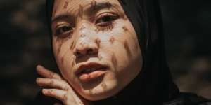 Ini Perbedaan Kulit Kering dan Dehidrasi