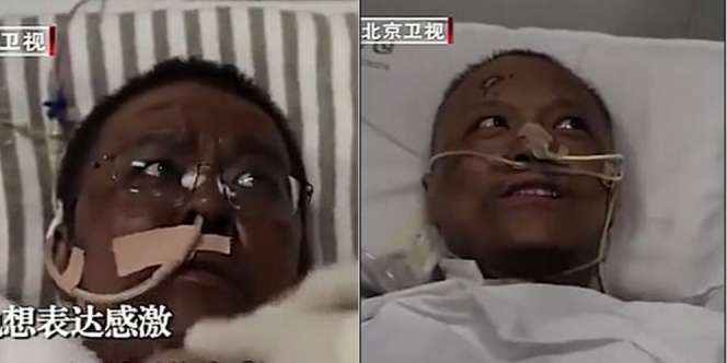 Dua Dokter di Wuhan Kritis Karena Covid-19, Saat Bangun Kulit Jadi Hitam