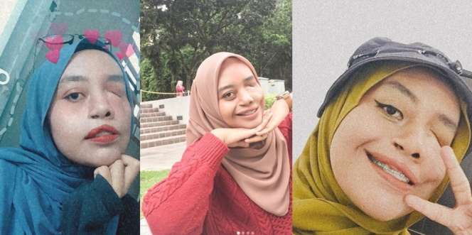 Dulu Diejek Dajjal, Kini Percaya Diri Unggah Foto Selfie
