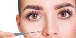 Tips Membersihkan Blackheads dengan Remover