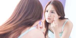 7 Penyebab Jerawat yang Sering Muncul di Pipi, Cara Mengobati dan Pencegahannya