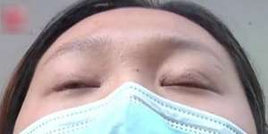 Penelitian: Virus Corona Lebih Cepat Menular Lewat Mata