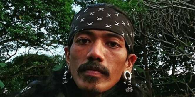 Bohim Preman Pensiun 4 Alami Kecelakan, Wajah Dipenuhi Perban