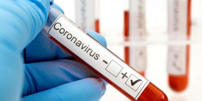 Kasus Covid-19 Terus Meningkat, Jangan Sampai Surabaya Seperti Wuhan