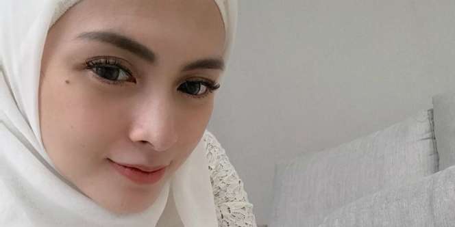 Ikutan 'Oplas', Wajah Asli Donita Malah Tuai Pujian