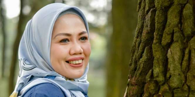Ikutan Oplas Challenge, Wajah Elly Sugigi Bikin Geger