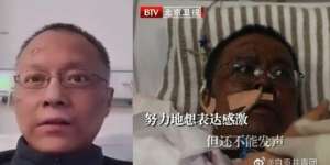 Dokter di Wuhan yang Kulitnya Jadi Hitam karena Covid-19 Meninggal Dunia