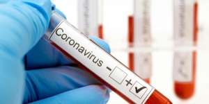 Jam Kerja Petugas Lab Ditambah 2 Kali Lipat Demi Target 20 Ribu Spesimen