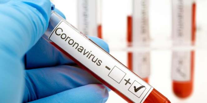 Jam Kerja Petugas Lab Ditambah 2 Kali Lipat Demi Target 20 Ribu Spesimen