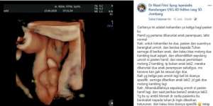 Viral, Pesan Dokter Kandungan Pentingnya Doa Khusus Saat Ingin Momongan 