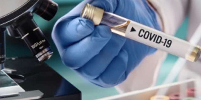 Pakar Virologi Udayana: Virus Corona Indonesia Tak Seganas di Wuhan