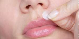 Cara Tepat Memakai Acne Patch Agar Efektif Atasi Jerawat