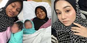 2 Kali Hamil, Wajah Mamah Muda Ini Berubah Hitam dan Teman Tak Mengenalinya
