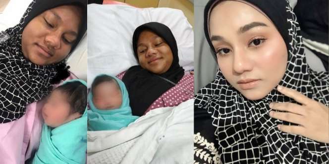 2 Kali Hamil, Wajah Mamah Muda Ini Berubah Hitam dan Teman Tak Mengenalinya