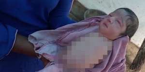 Dipastikan Normal, Saat Lahir Bayi Ini Tak Punya Kaki dan Tangan